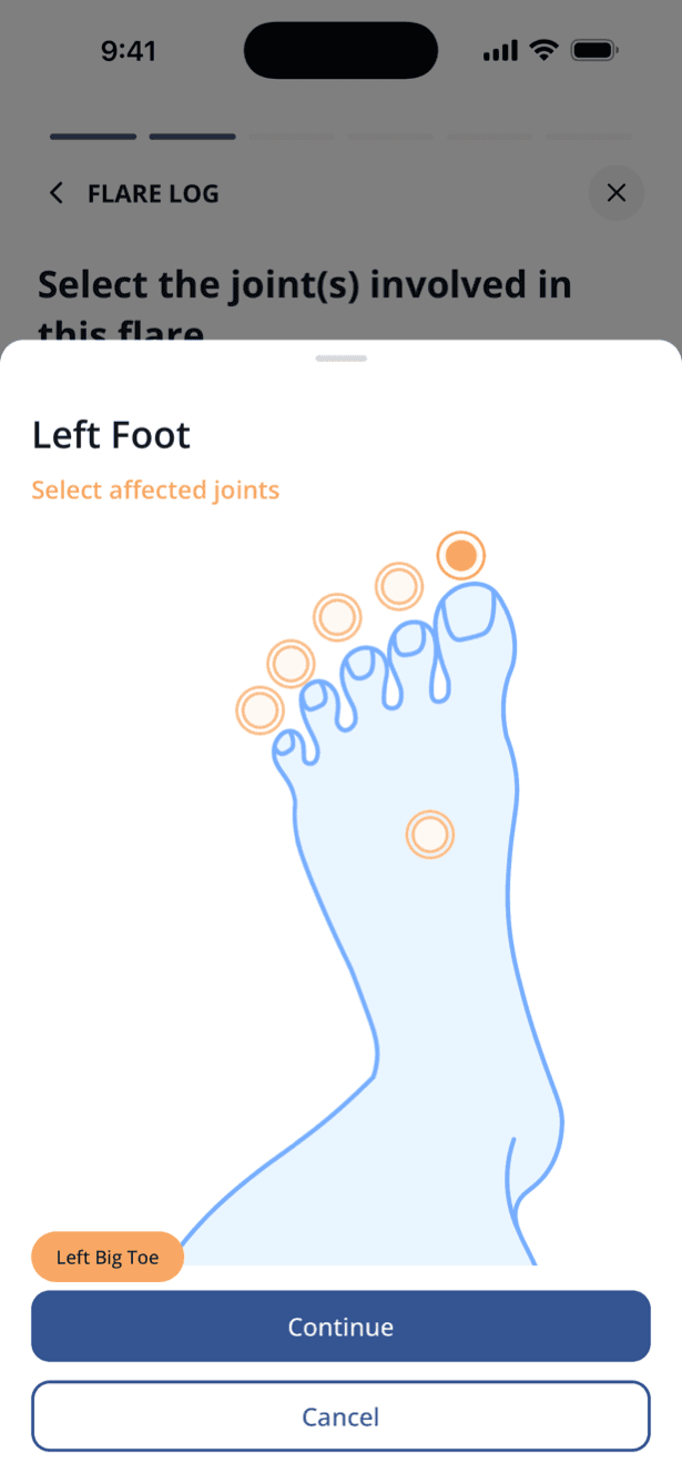Flarebreak flare log: a foot diagram with the left big toe joint selected and labeled.